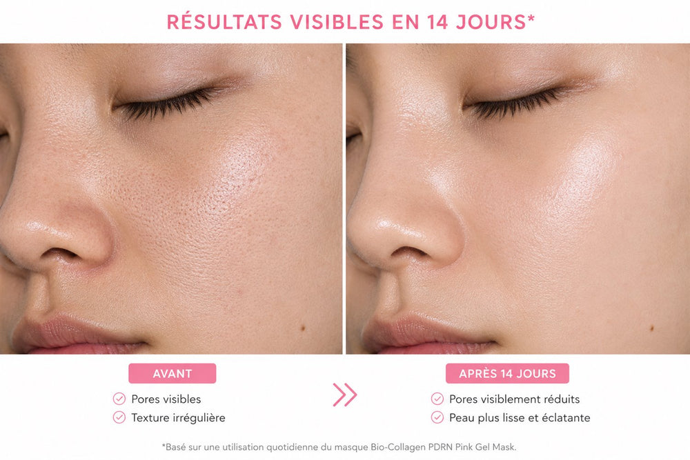 Résultats du duo niacinamide et collagène sur le teint