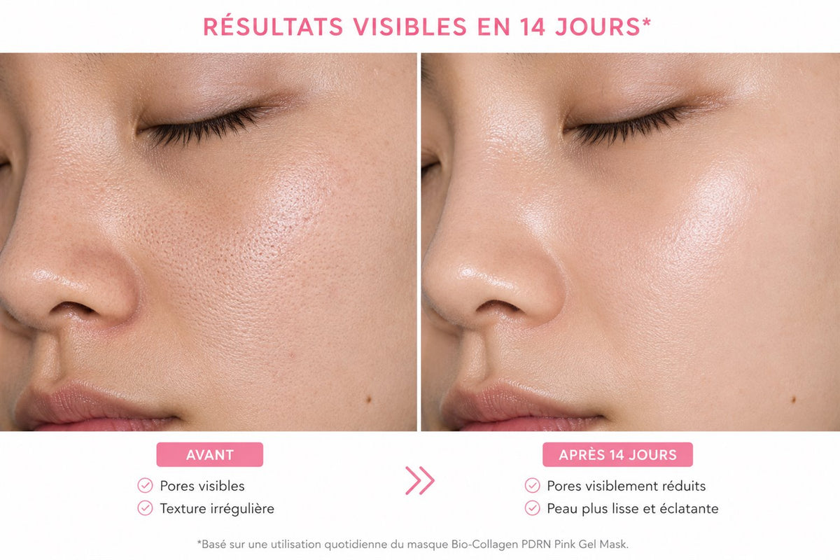 Résultats du duo niacinamide et collagène sur le teint